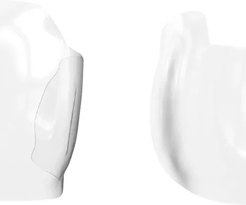 Bioclear matrisesystem