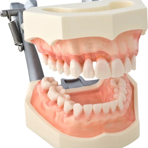 Parodontiemodell med mykt, transparent tannkjøtt P15D-162H1
