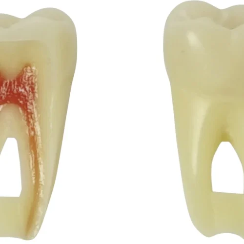 Modelltanner ANA-4 ZPURN