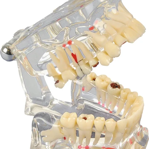 Studiemodell Transparent De Luxe