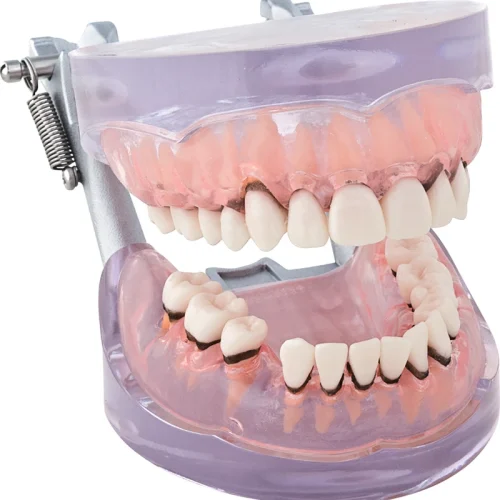 Parodontiemodell P15D-TRM205