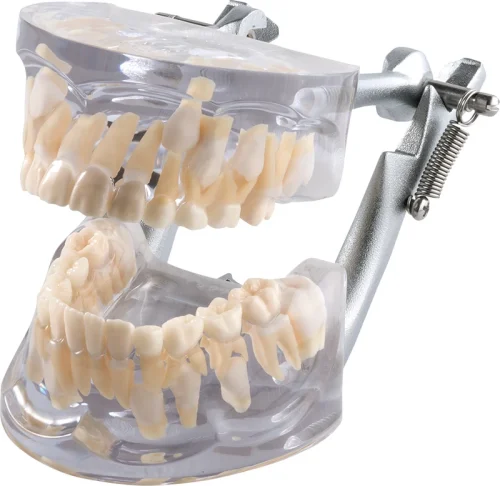 Vekstmodell transparent OK + UK P12D-100A