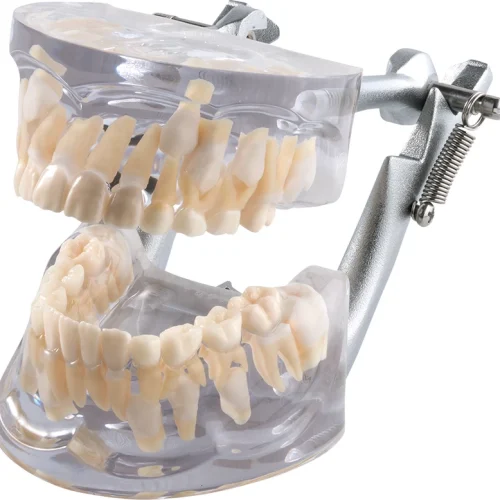 Vekstmodell transparent OK + UK P12D-100A