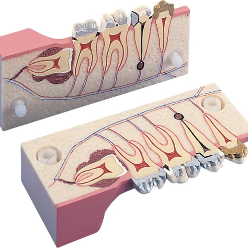 2-delt jeksel modell P13-TR9