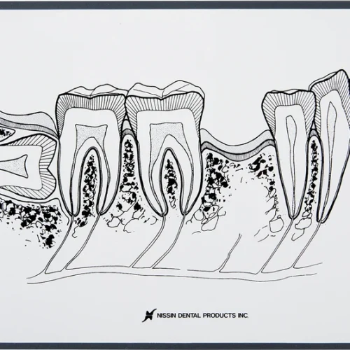 Demonstrasjonstavle sidetannområde P13-TR200