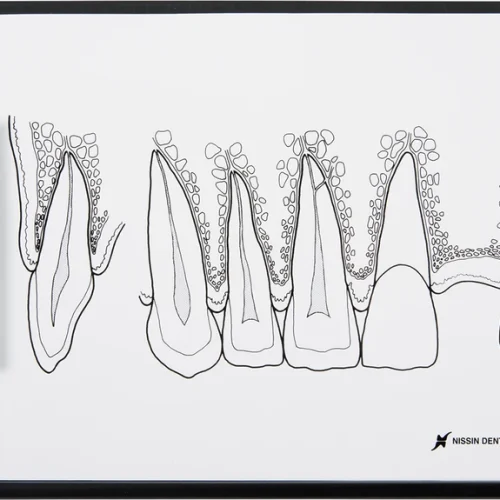 Demonstrasjonstavle fronttannområde P13-TR200A