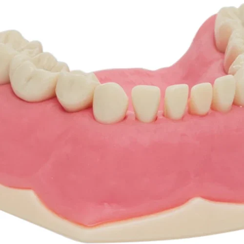 Barnetannmodell AK-6