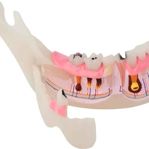 Patologisk halv UK modell P13-TR10