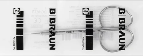 tenotomissaks etter Stevens