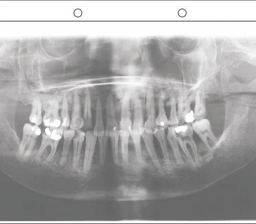 Panostar® filmlommer