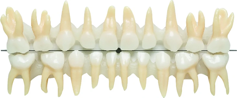 Anatomiske melketenner