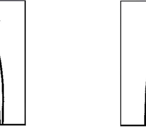 KKD® saks TC Line etter Goldman Fox