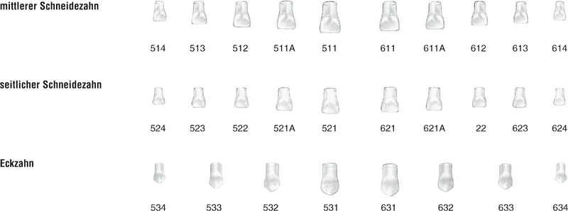 Strip-kroner barn klar